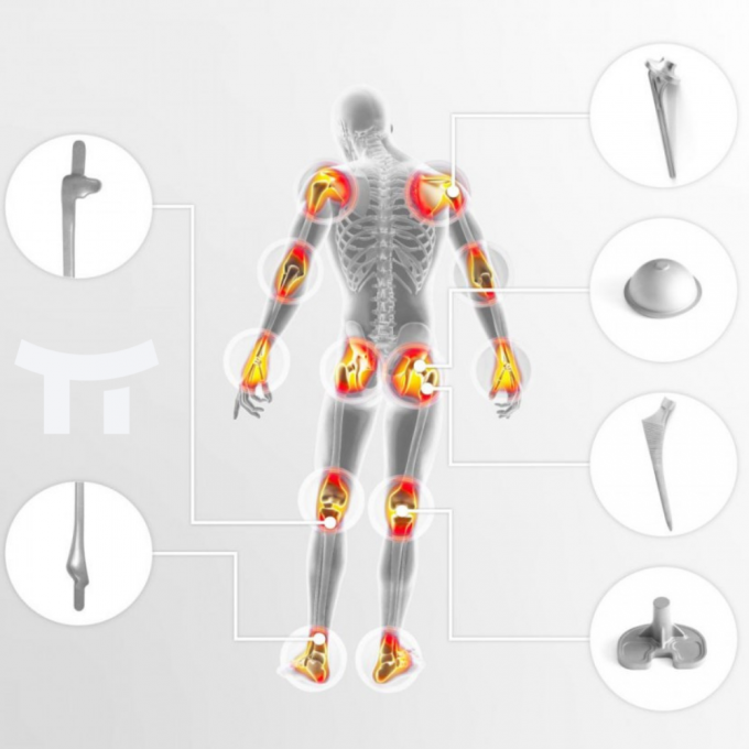 latest company news about BaseTi's in Medical Titanium: Transforming Orthopedic Treatments  0